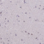 Immunohistochemical staining of human cerebral cortex shows no positivity in neurons as expected.