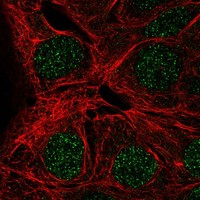 Anti-MAGEA9 Antibody