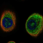 Immunofluorescent staining of human cell line hTCEpi shows localization to nucleoli & intermediate filaments.
