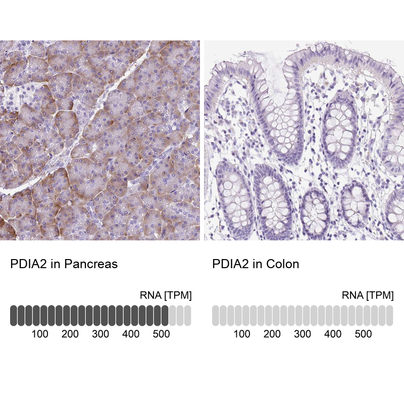 Anti-PDIA2 Antibody
