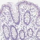 Immunohistochemical staining of human colon shows low expression as expected.