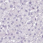 Immunohistochemical staining of human liver using Anti-PDIA2 antibody HPA051692.