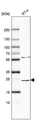 Anti-RAB11A Antibody