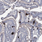 Anti-TAAR5 Antibody