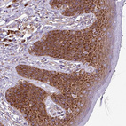 Immunohistochemical staining of human skin shows strong cytoplasmic positivity in squamous epithelial cells.