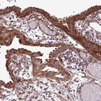 Immunohistochemical staining of human fallopian tube shows strong cytoplasmic positivity in glandular cells.