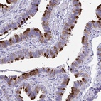 Anti-TTC30A Antibody