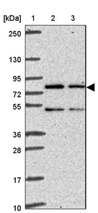 Lane 1: Marker [kDa] 250, 130, 95, 72, 55, 36, 28, 17, 10_br/_Lane 2: Human cell line RT-4_br/_Lane 3: Human cell line U-251 MG