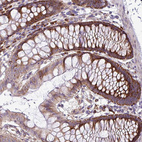 Immunohistochemical staining of human colon shows moderate cytoplasmic positivity in glandular cells.