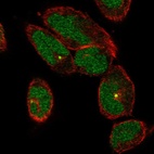 Anti-TTC30A Antibody