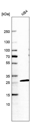 Western blot analysis in human cell line NB4.
