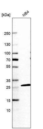 Western blot analysis in human cell line NB4.