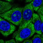 Immunofluorescent staining of human cell line MCF7 shows localization to nucleoli, cytosol & endoplasmic reticulum.