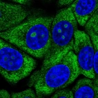 Immunofluorescent staining of human cell line MCF7 shows localization to nucleoli, cytosol & endoplasmic reticulum.