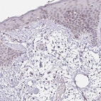 Immunohistochemical staining of human skin shows weak positivity in nucleoli in squamous epithelial cells.