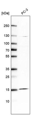 Western blot analysis in human cell line PC-3.