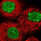 Immunofluorescent staining of human cell line A-431 shows localization to nucleus & nucleoli.