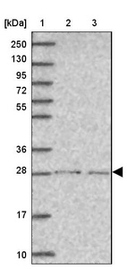 Lane 1: Marker [kDa] 250, 130, 95, 72, 55, 36, 28, 17, 10_br/_Lane 2: Human cell line RT-4_br/_Lane 3: Human cell line U-251 MG