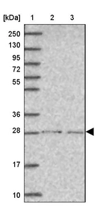 Lane 1: Marker [kDa] 250, 130, 95, 72, 55, 36, 28, 17, 10_br/_Lane 2: Human cell line RT-4_br/_Lane 3: Human cell line U-251 MG