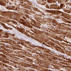 Immunohistochemical staining of human heart muscle shows high expression.