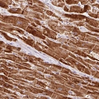 Immunohistochemical staining of human heart muscle shows high expression.