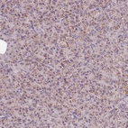 Anti-NDUFB4 Antibody