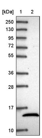 Lane 1: Marker [kDa] 250, 130, 95, 72, 55, 36, 28, 17, 10_br/_Lane 2: Human cell line RT-4
