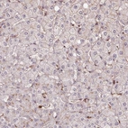 Immunohistochemical staining of human liver shows low expression as expected.