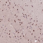 Immunohistochemical staining of human cerebral cortex shows high expression.