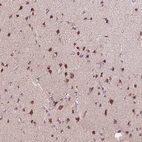 Immunohistochemical staining of human cerebral cortex shows high expression.