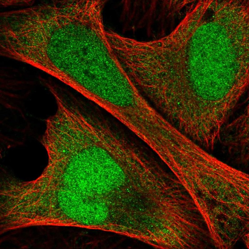 Anti-ANKRD36C Antibody