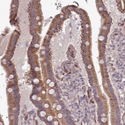 Immunohistochemical staining of human duodenum shows strong cytoplasmic positivity in glandular cells.