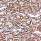 Immunohistochemical staining of human kidney shows strong cytoplasmic positivity in cells in tubules.