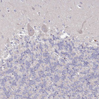Anti-RPL23A Antibody