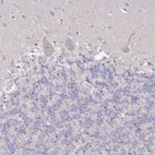 Immunohistochemical staining of human cerebellum shows no positivity in Purkinje cells as expected.