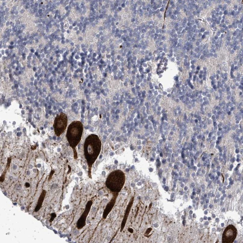 Anti-AMMECR1 Antibody
