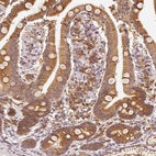 Immunohistochemical staining of human duodenum shows strong cytoplasmic positivity in glandular cells.