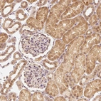 Immunohistochemical staining of human kidney shows moderate cytoplasmic positivity in cells in tubules.
