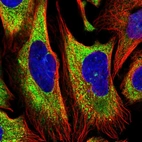 Immunofluorescent staining of human cell line U-2 OS shows localization to cytosol.