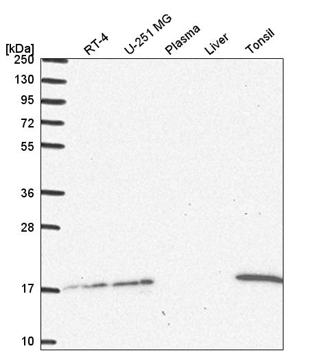 Anti-UBE2A Antibody