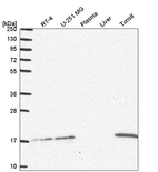 Anti-UBE2A Antibody