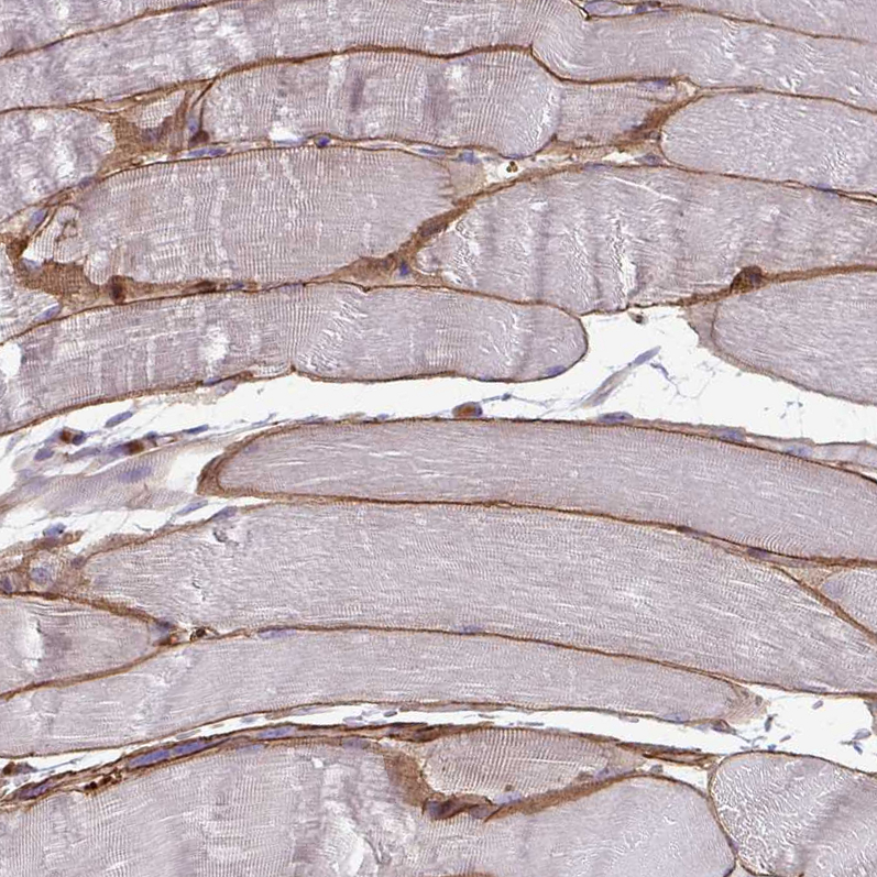 Anti-ADIPOQ Antibody