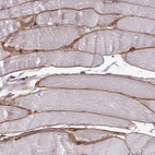 Anti-ADIPOQ Antibody