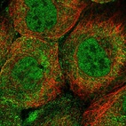 Immunofluorescent staining of human cell line A-431 shows localization to nucleoplasm & vesicles.