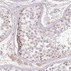 Anti-TDRD15 Antibody