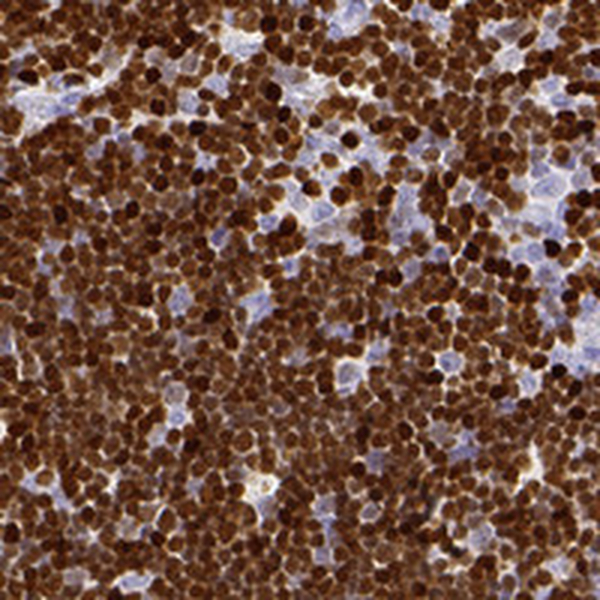 Anti-SATB1 Antibody