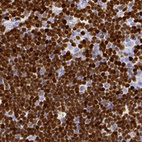 Anti-SATB1 Antibody