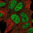 Immunofluorescent staining of human cell line HEK 293 shows localization to nucleoplasm.