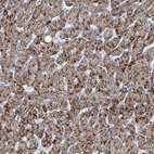 Anti-ACBD4 Antibody