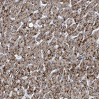 Anti-ACBD4 Antibody